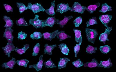 L’AI prevede la disposizione delle cellule staminali umane
