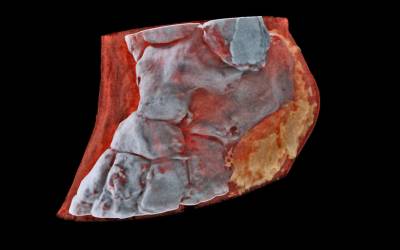 Le prime immagini a raggi X a colori del corpo umano