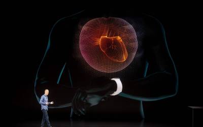 Cosa pensano i cardiologi del’ECG di Apple Watch