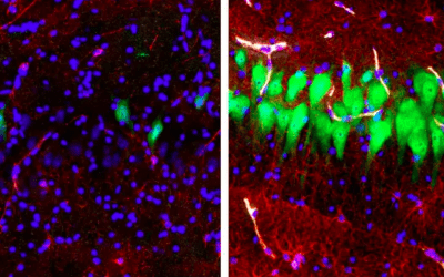 Riattivate cellule cerebrali morte, cosa che potrebbe cambiare la nostra visione della morte