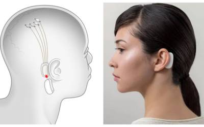 Neuralink di Elon Musk collega il cervello all’intelligenza artificiale