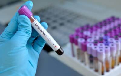 Test sul coronavirus: dalla Svizzera arriva Elecsys