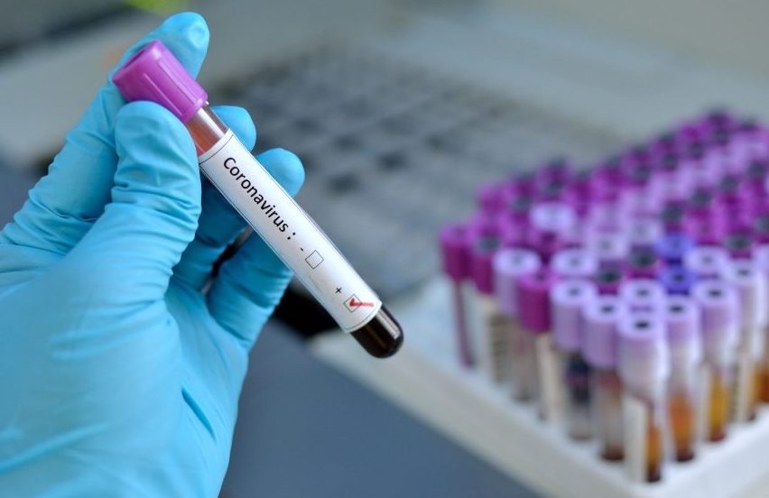 Test sul coronavirus: dalla Svizzera arriva Elecsys