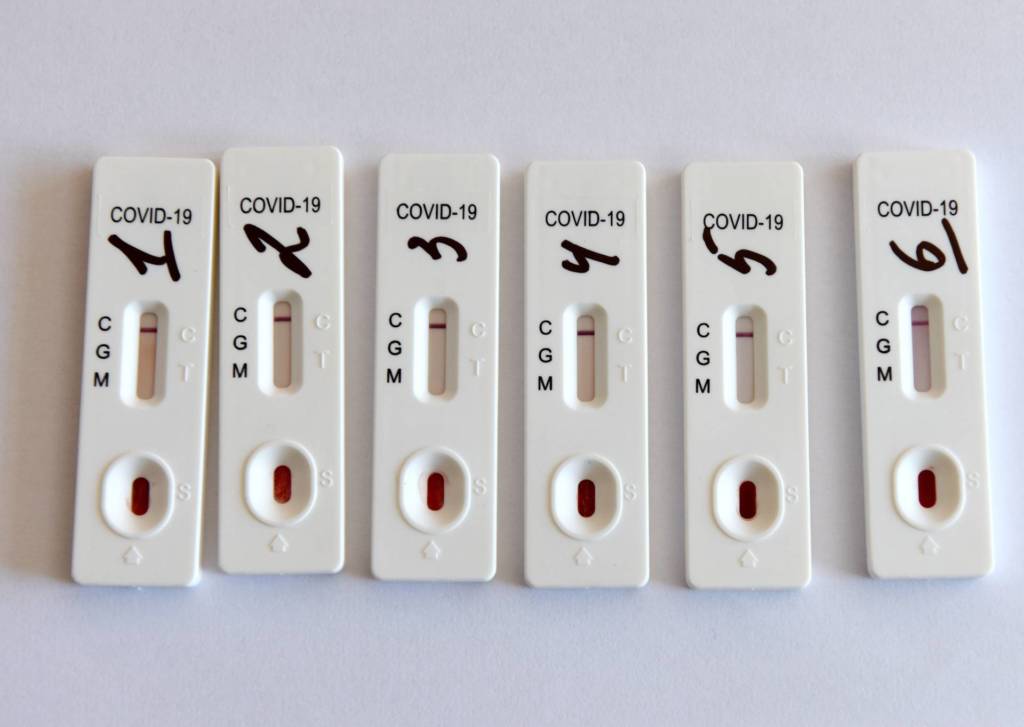 Kit Test Coronavirus Covid19